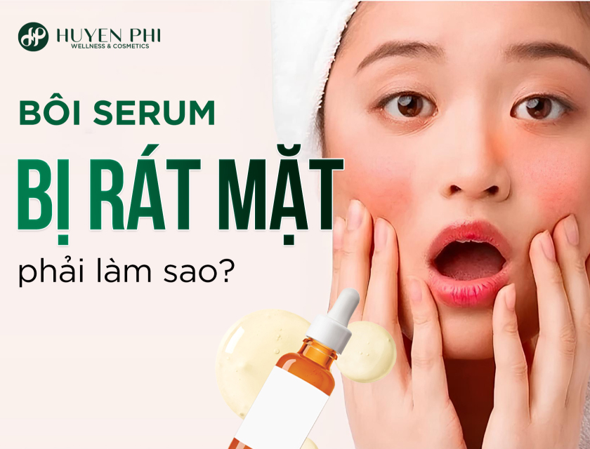 Boi Serum Bi Rat Mat 1