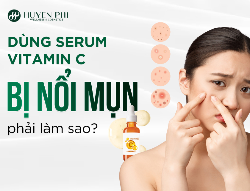 Dung Serum Vitamin C Bi Noi Mun 1