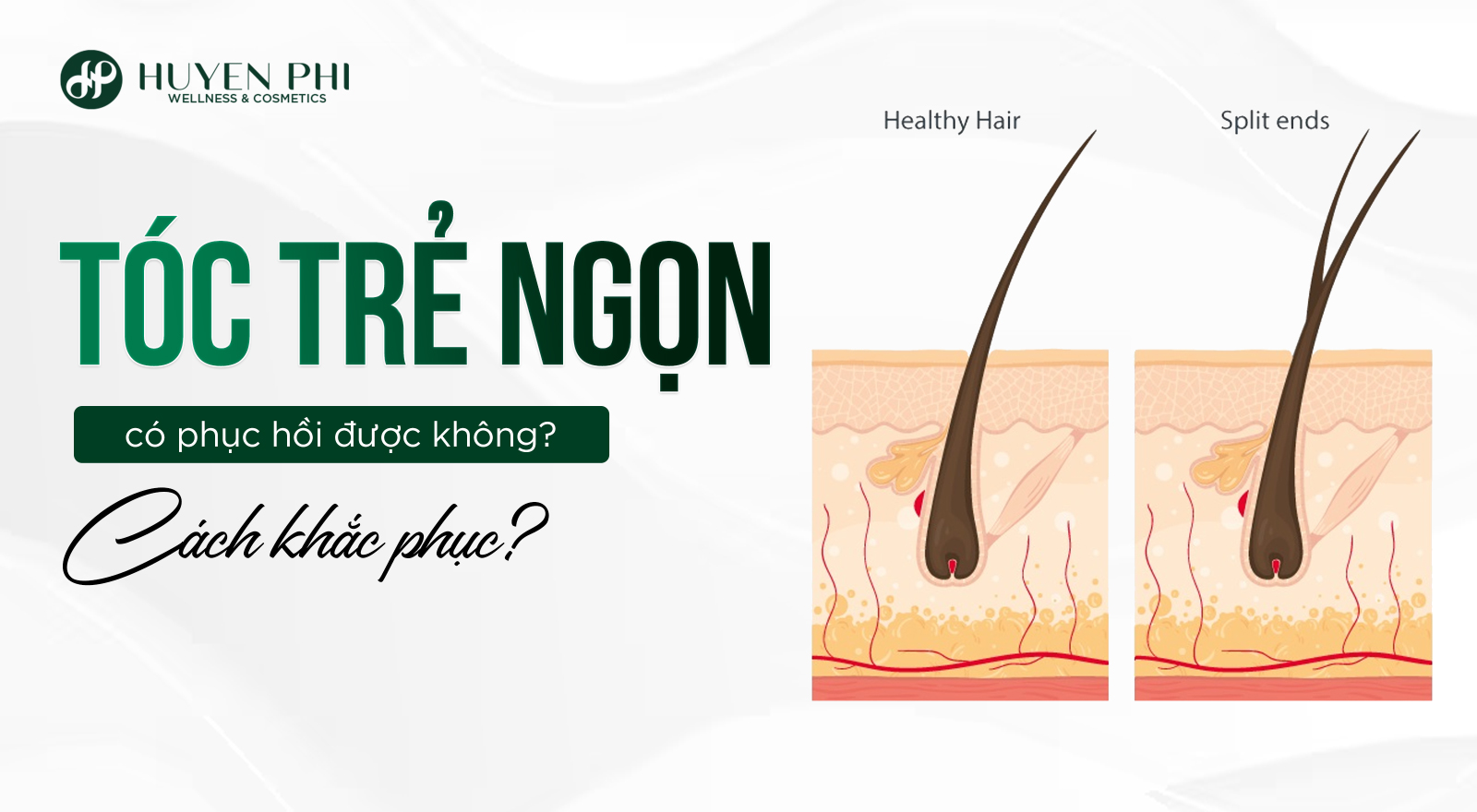 Tóc chẻ ngọn có phục hồi được không? Cách khắc phục?