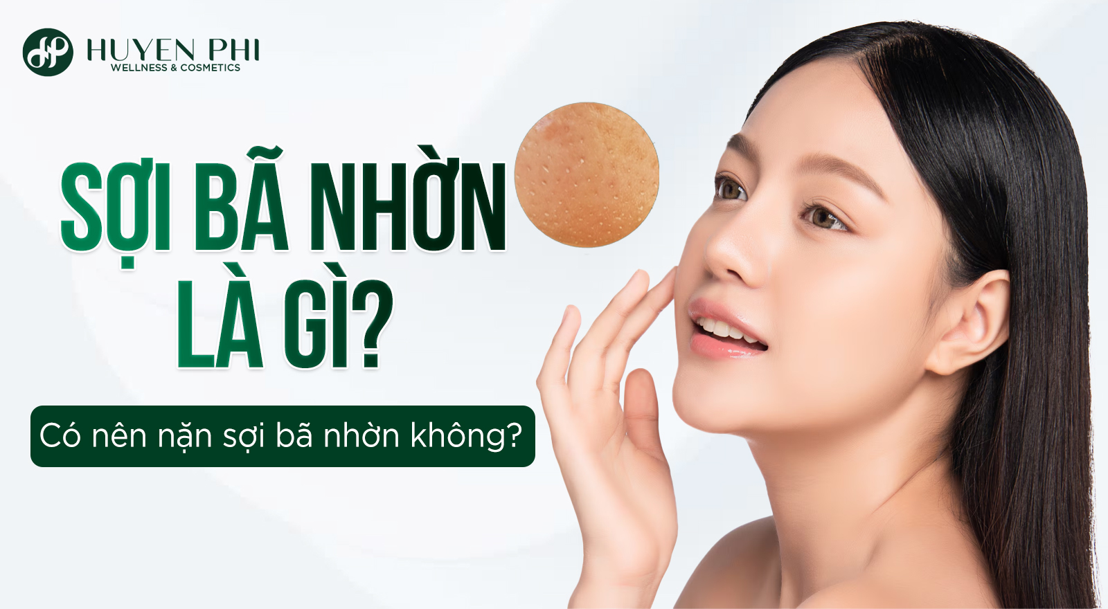 Sợi bã nhờn là gì? Có nên nặn sợi bã nhờn không?