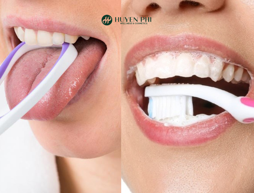cách trị hôi miệng sau 1 đêm