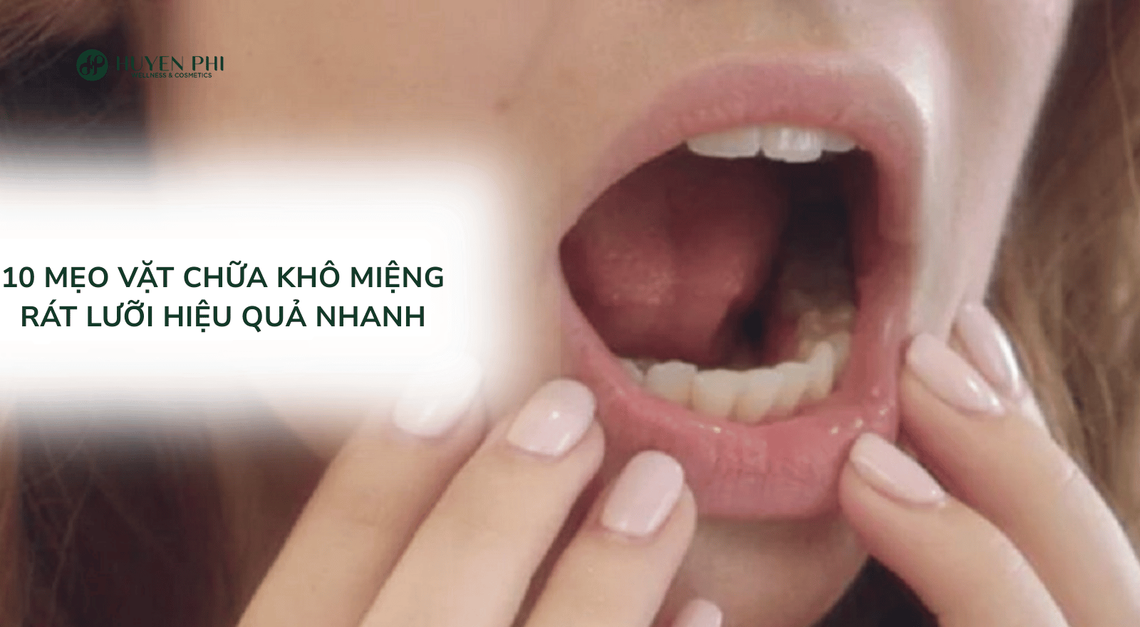 10 mẹo vặt chữa khô miệng rát lưỡi hiệu quả nhanh