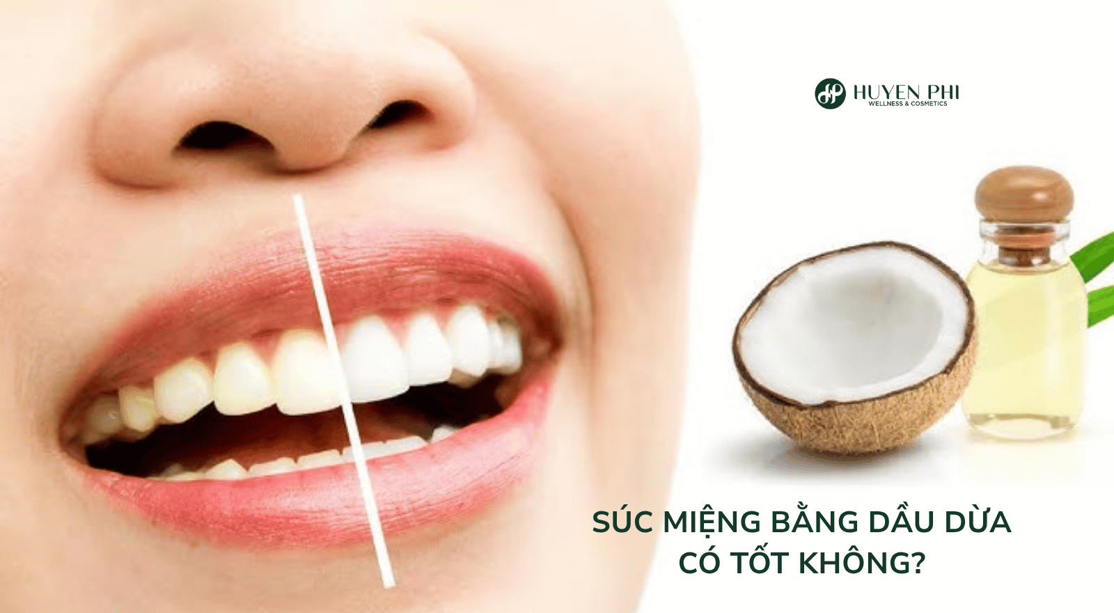 Súc miệng bằng dầu dừa có tốt không? Cách thực hiện